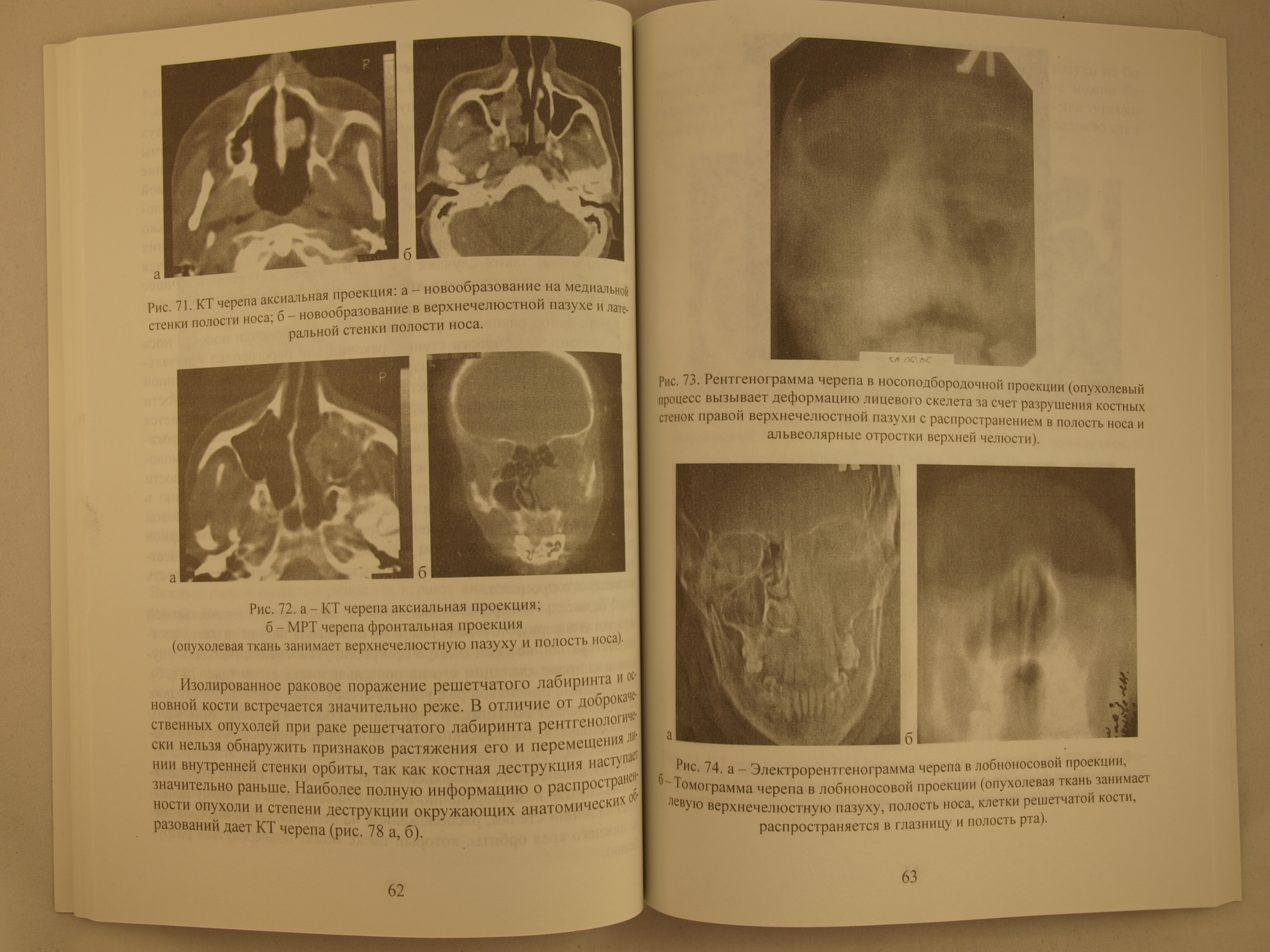 Рентгенодиагностика в оториноларингологии